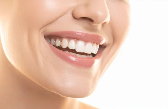 teeth-whitening-update.png.bv teeth-whitening-update.png.bv