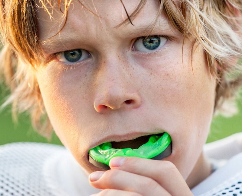 custom mouth guards in se calgary